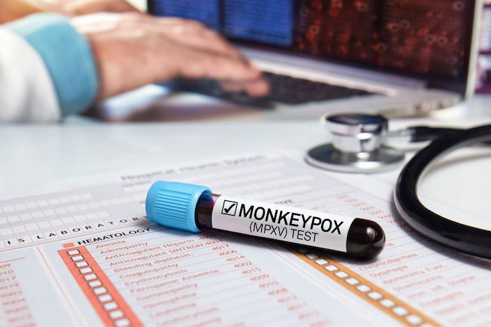 Canadian travellers urged to take precautions against monkeypox abroad